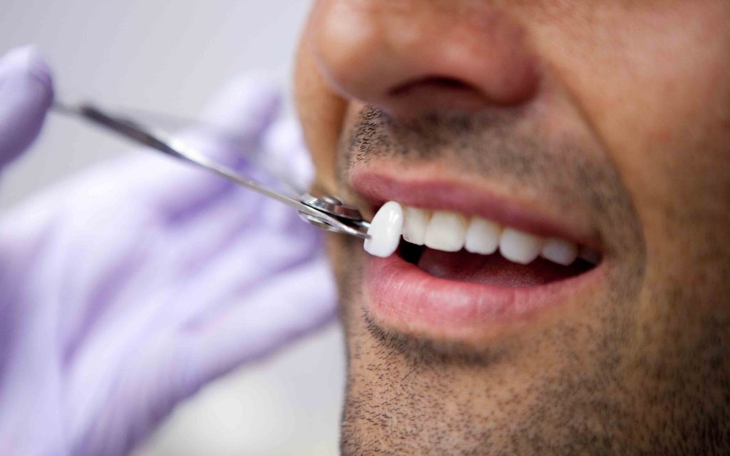 Get Dental Clinic in Pimple Saudagar | Dental Veneers Clinic in Pimple Saudagar - Dr. Shirish Yadav